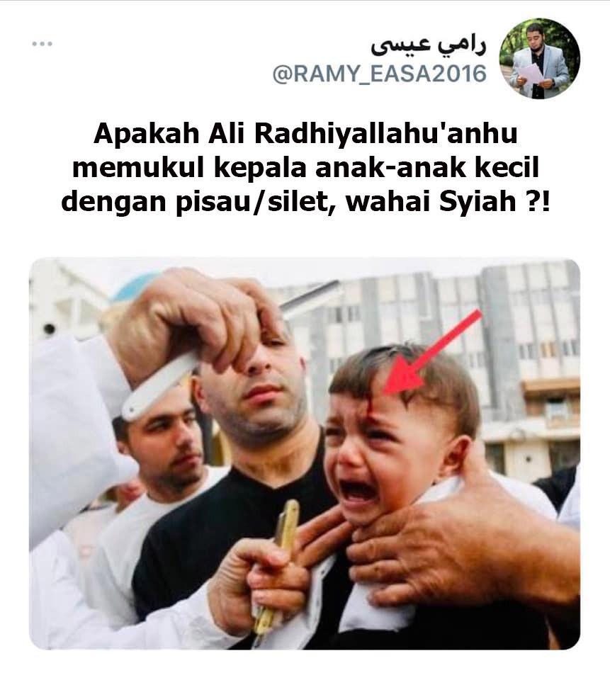 Apakah Ali Radhiyallahu'anhu memukul kepala anak-anak kecil dengan pisau/silet, wahai Syiah ?!