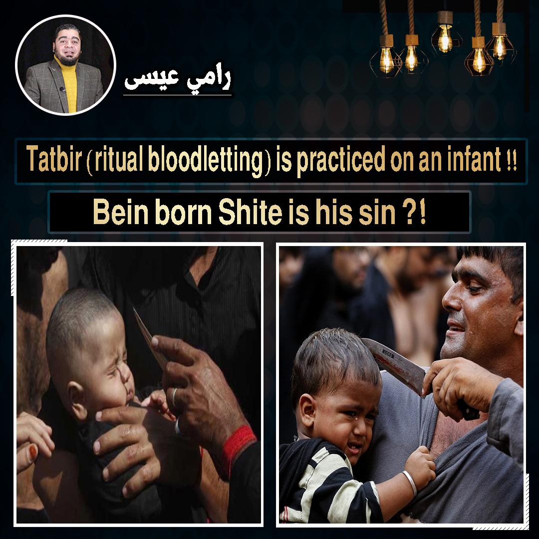 Tatbir (ritual bloodletting) is practiced on an infant